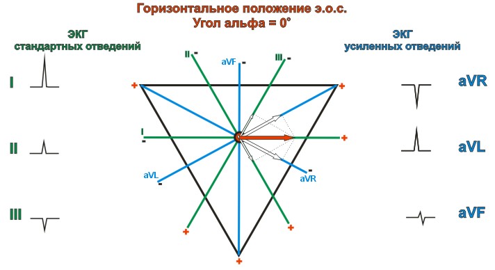 Горизонтальная электрическая ось сердца