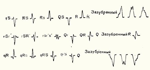 QRS-комплекс
